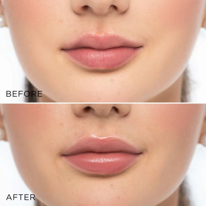 ARTDECO Glossy Lip Volumizer | La Cosmetique